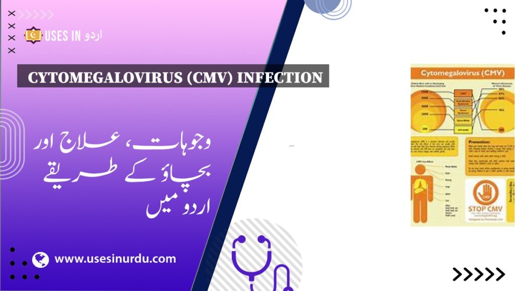 Cytomegalovirus (CMV) Infection