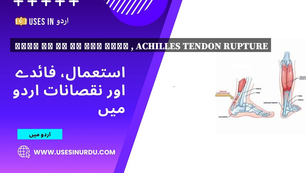 ایڑی کی رگ کا پھٹ جانا , Achilles Tendon Rupture