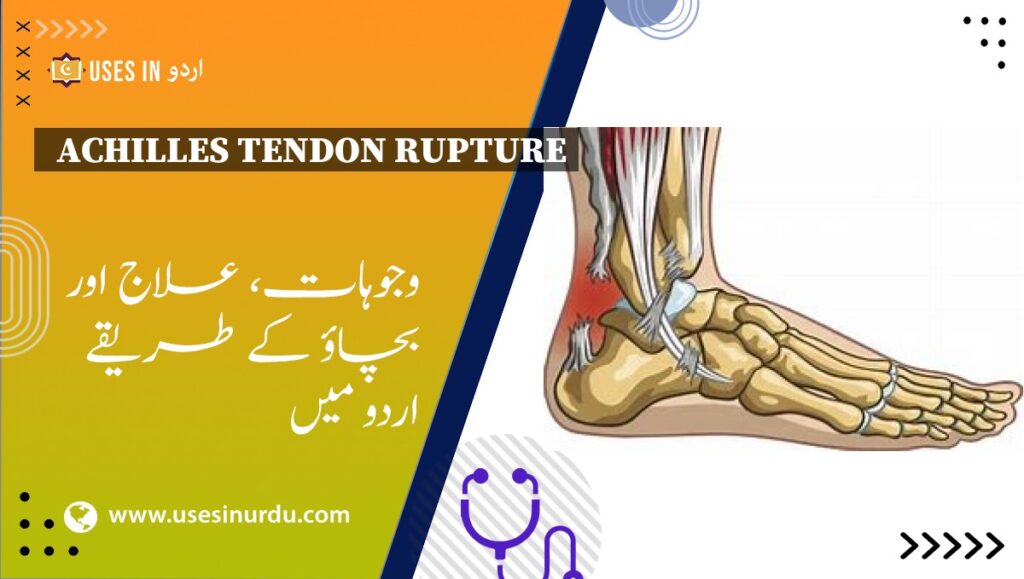 Achilles Tendon Rupture