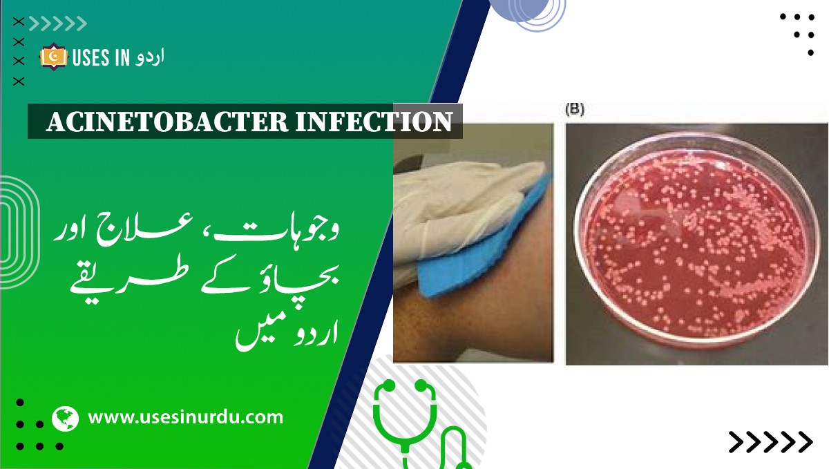 Acinetobacter Infection