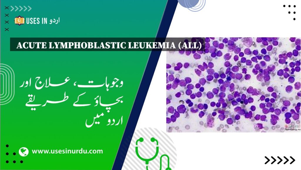 Acute Lymphoblastic Leukemia (ALL)