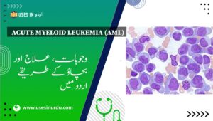 Acute Myeloid Leukemia (AML)