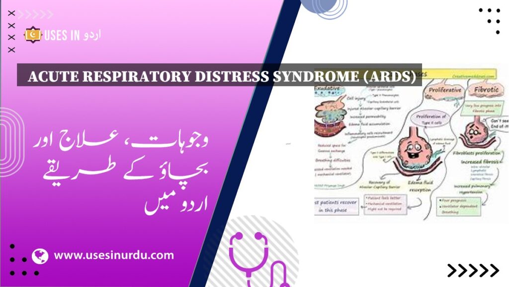 Acute Respiratory Distress Syndrome (ARDS)