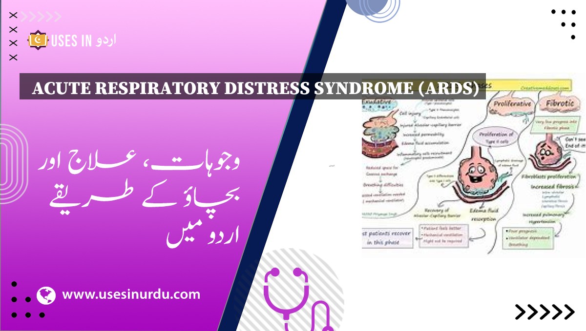 Acute Respiratory Distress Syndrome (ARDS)