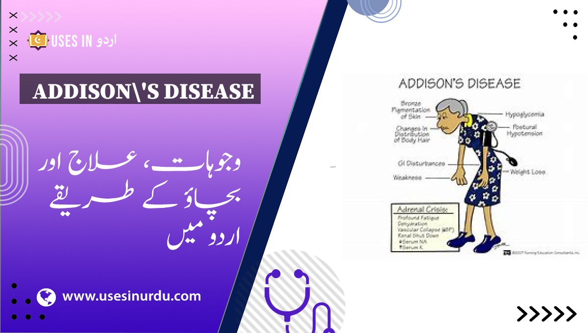 Addison's Disease