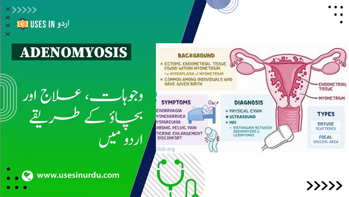 Adenomyosis