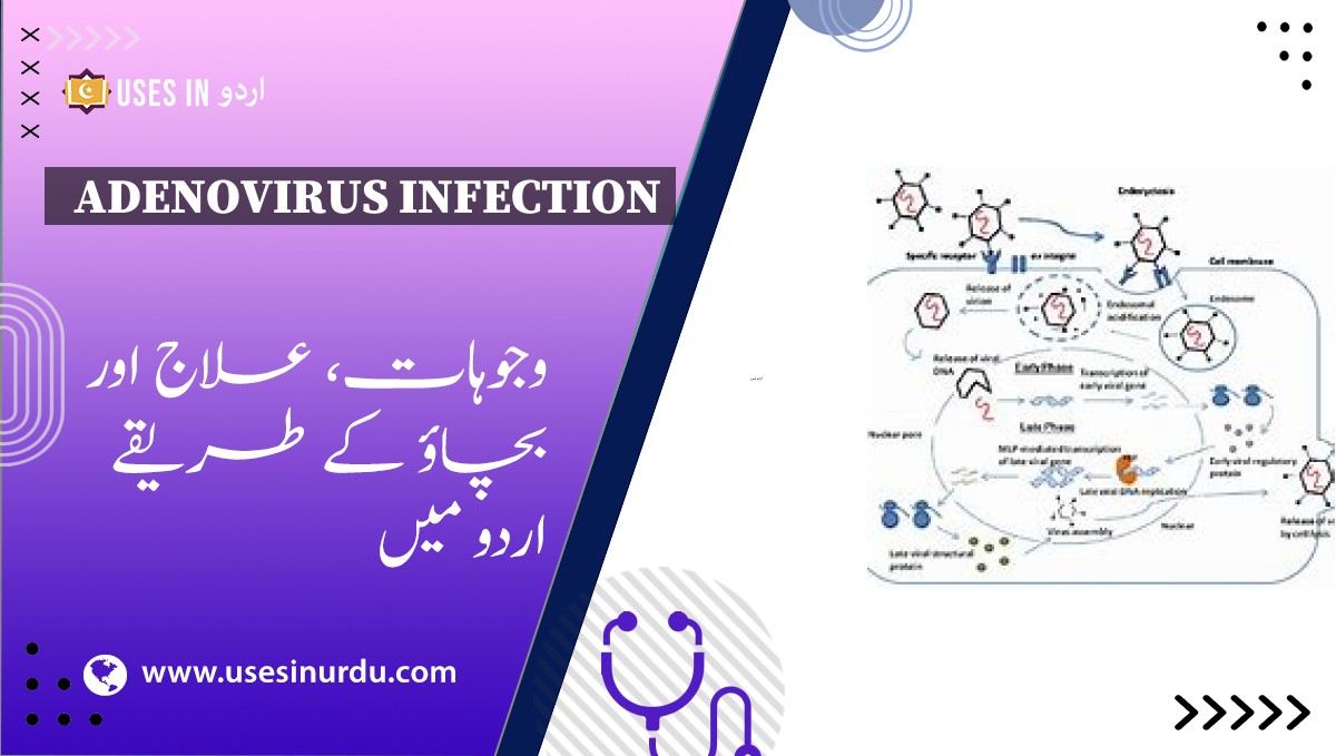 Adenovirus Infection