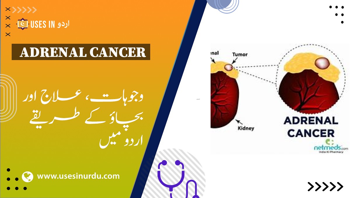 Adrenal Cancer