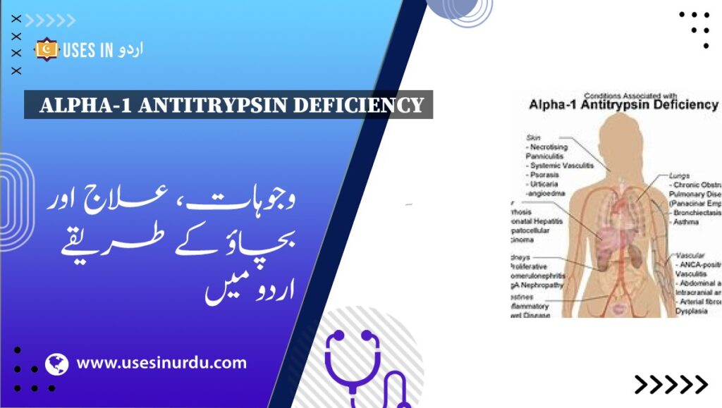 Alpha-1 Antitrypsin Deficiency