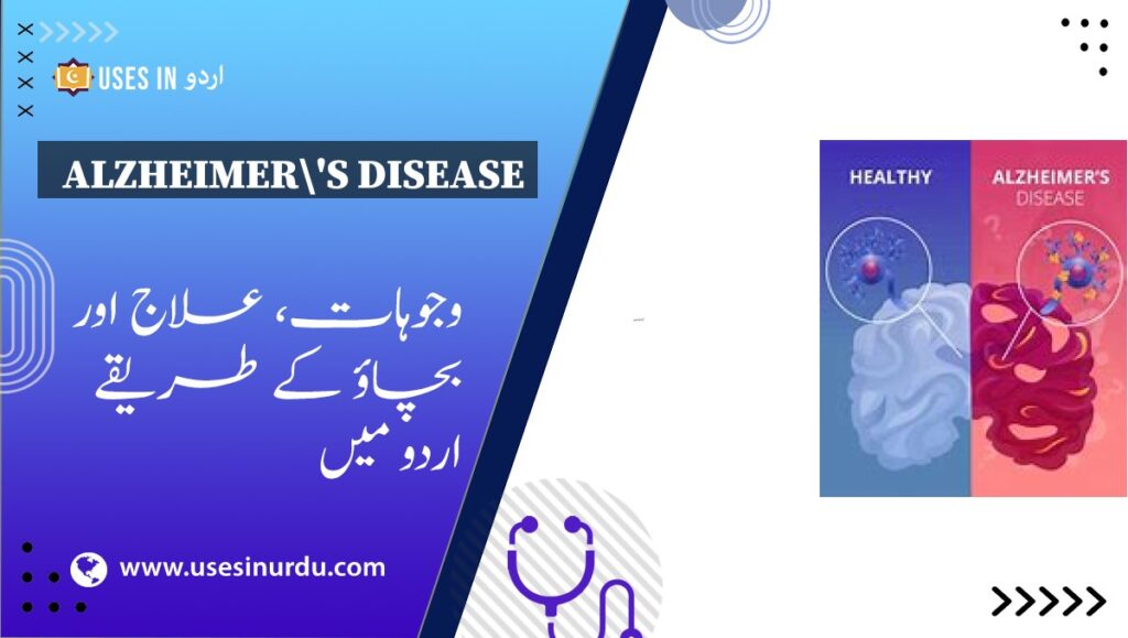 Alzheimer's Disease