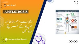 Amyloidosis
