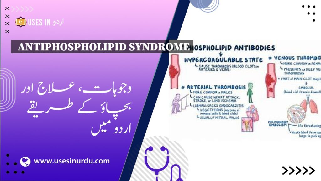 Antiphospholipid Syndrome