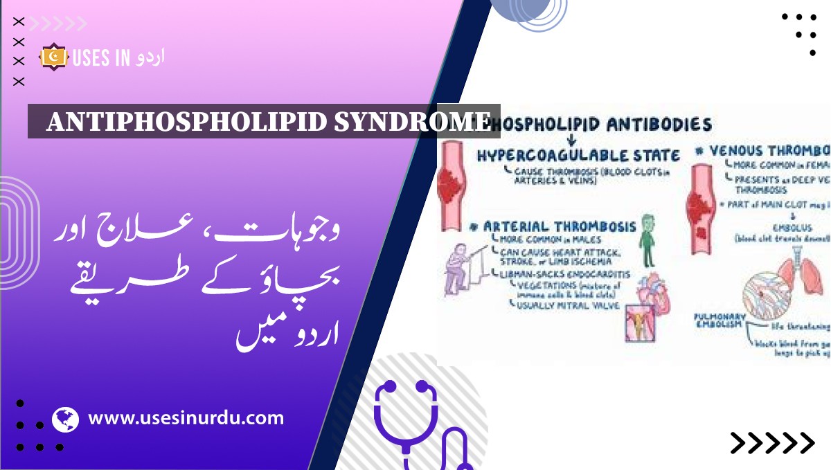 Antiphospholipid Syndrome