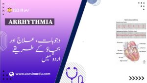 Arrhythmia