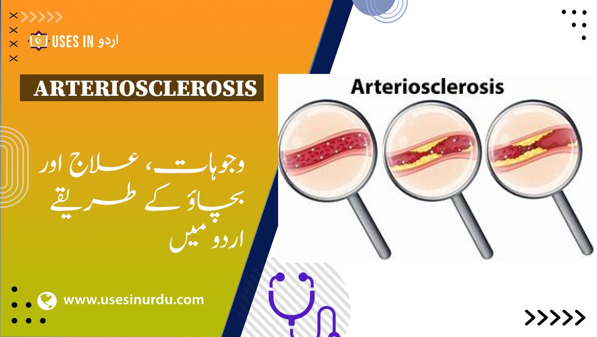 Arteriosclerosis