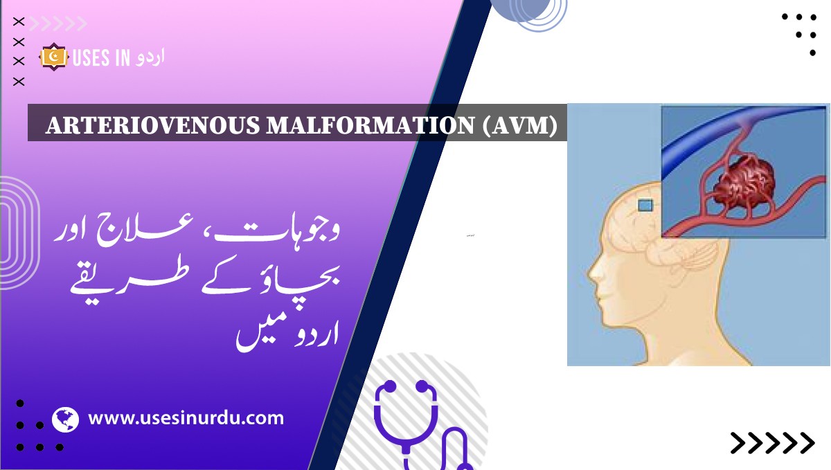 Arteriovenous Malformation (AVM)