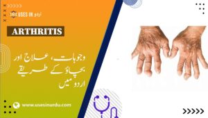 Arthritis