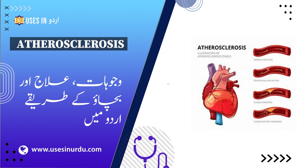 Atherosclerosis