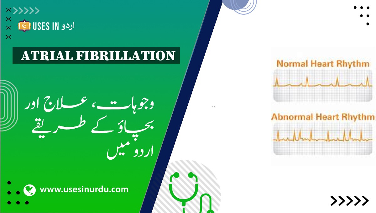 Atrial Fibrillation