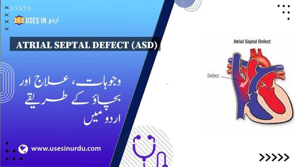 Atrial Septal Defect (ASD)