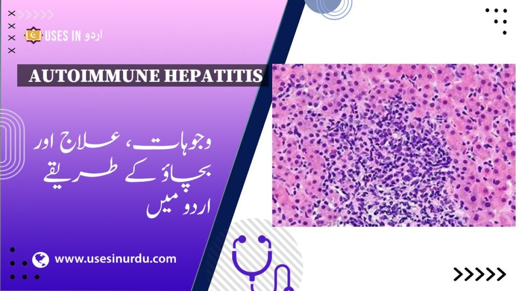 Autoimmune Hepatitis