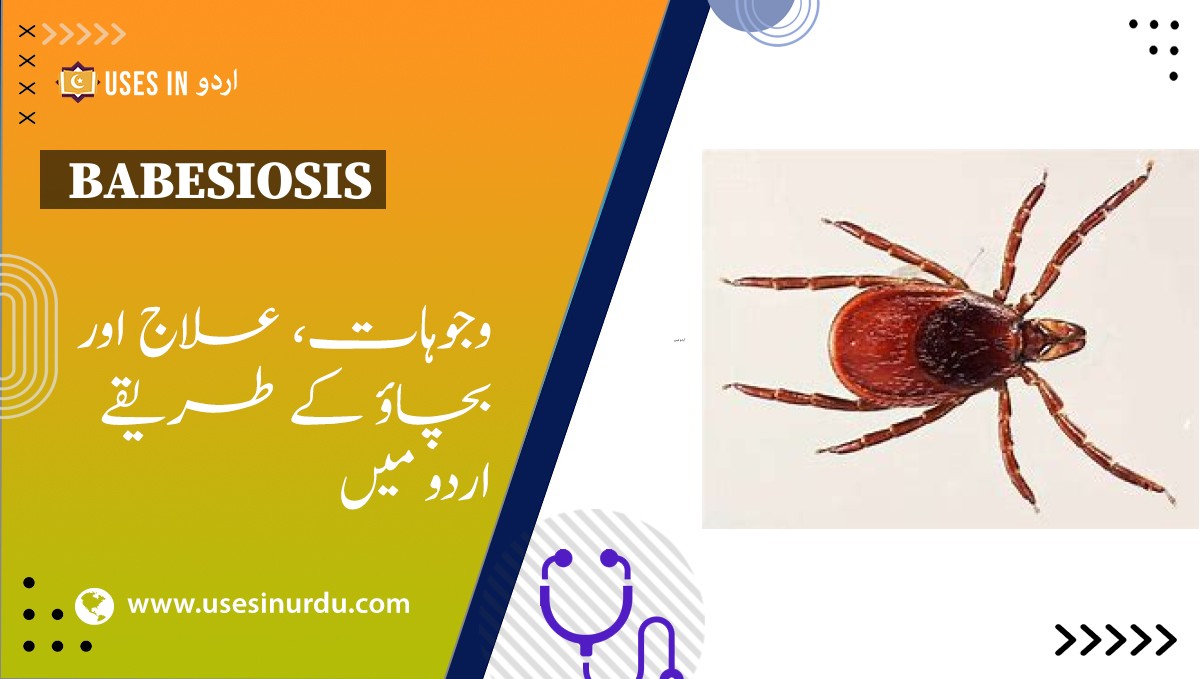 Babesiosis