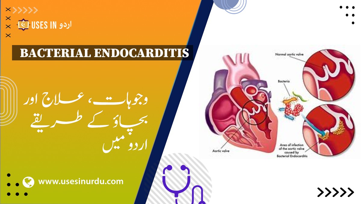 Bacterial Endocarditis