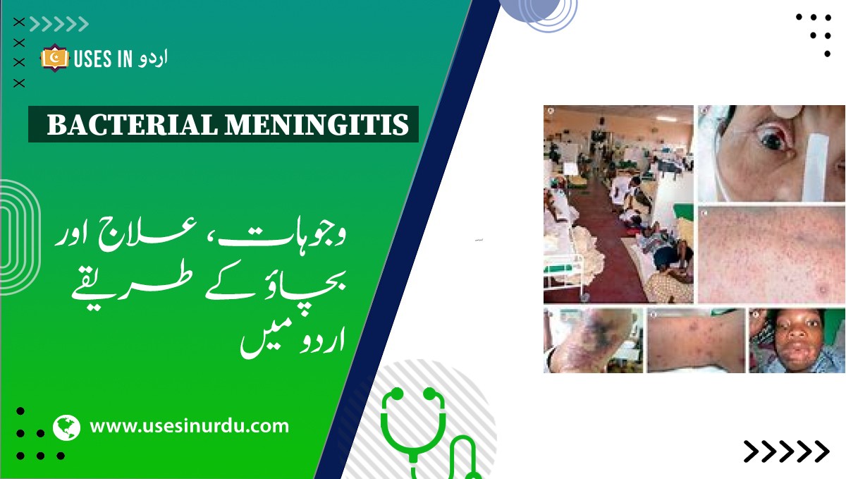 Bacterial Meningitis