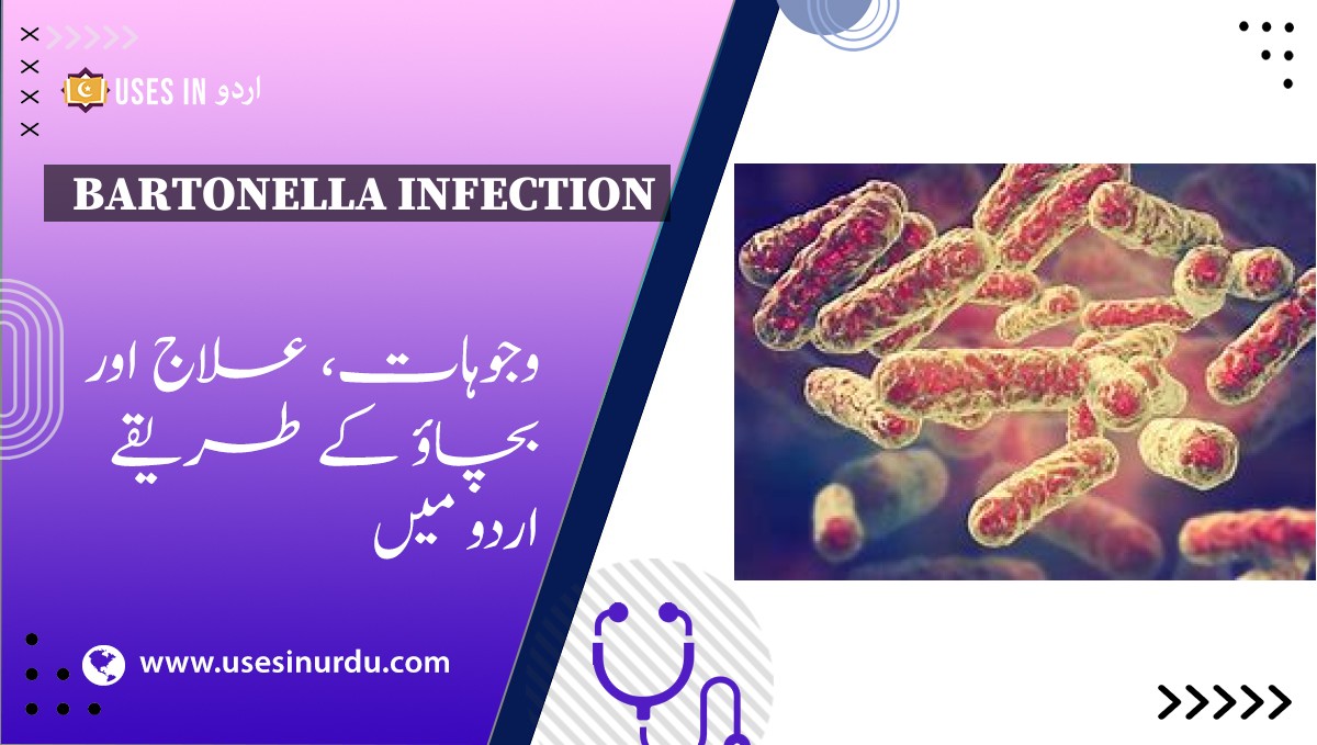 Bartonella Infection