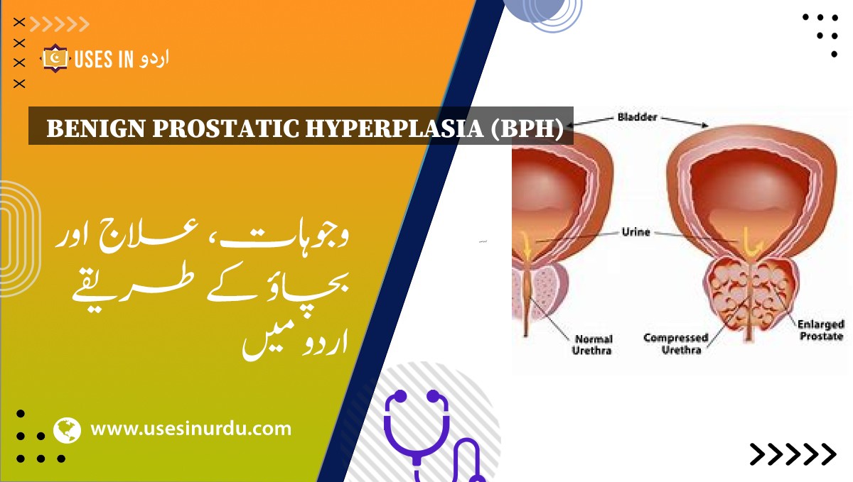 Benign Prostatic Hyperplasia (BPH)