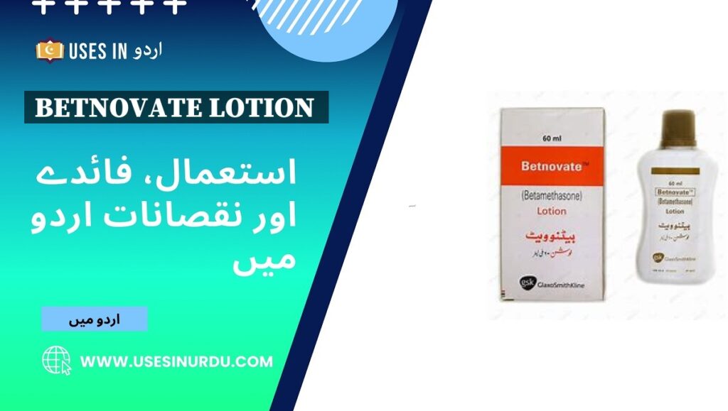 Betnovate Lotion