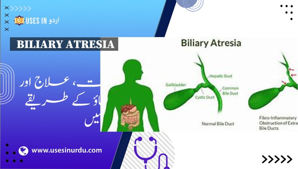 Biliary Atresia