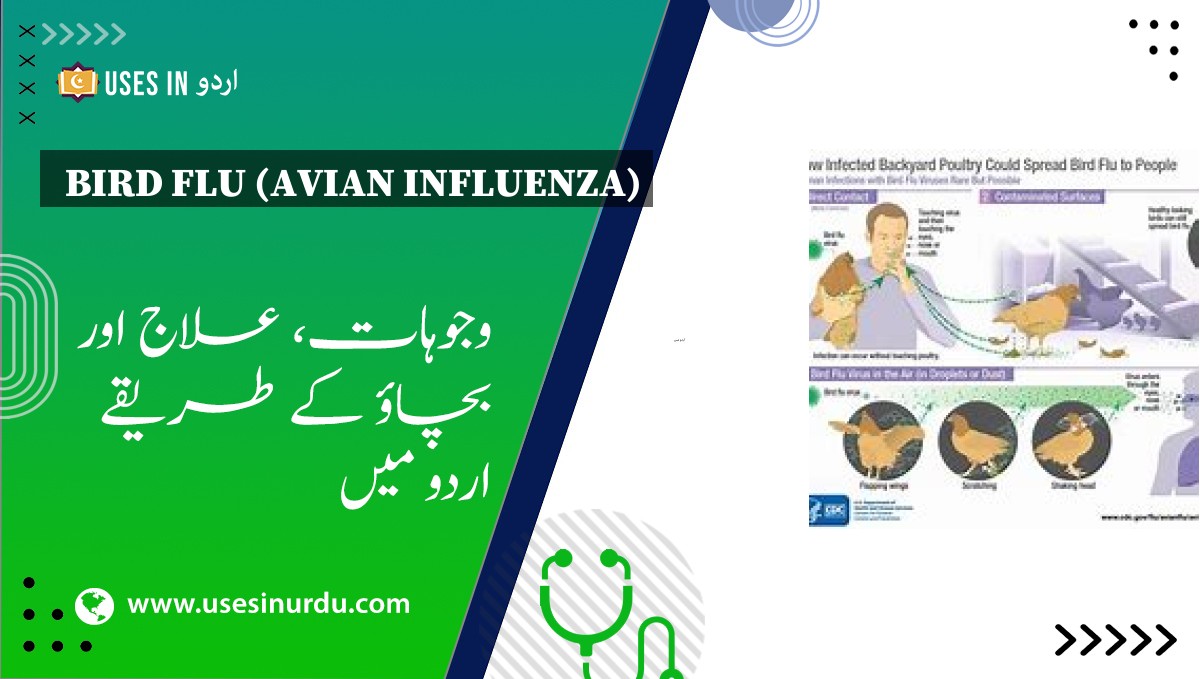 Bird Flu (Avian Influenza)