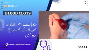 Blood Clots