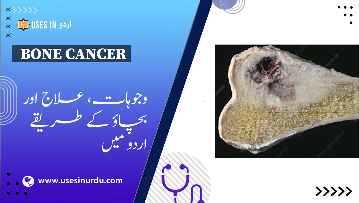 Bone Cancer