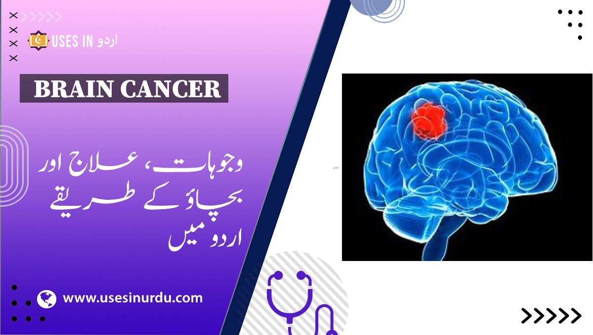 Brain Cancer