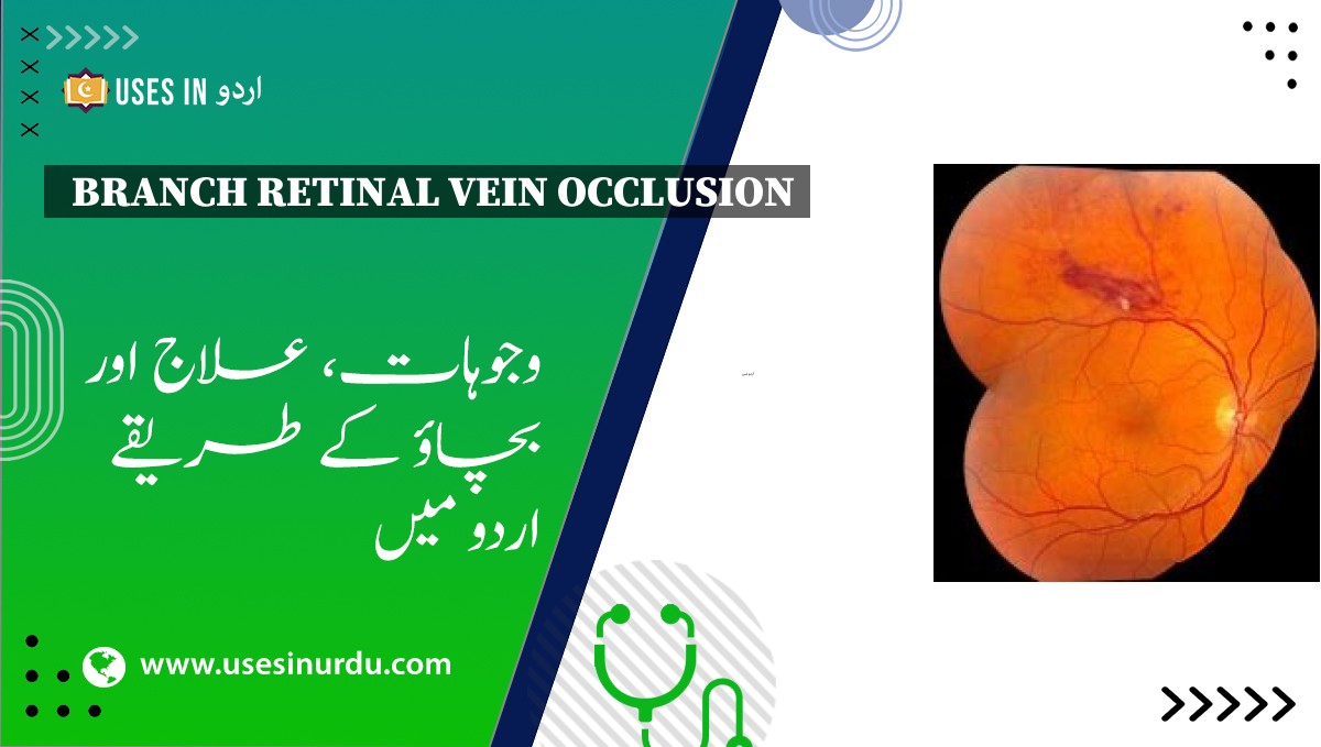 Branch Retinal Vein Occlusion