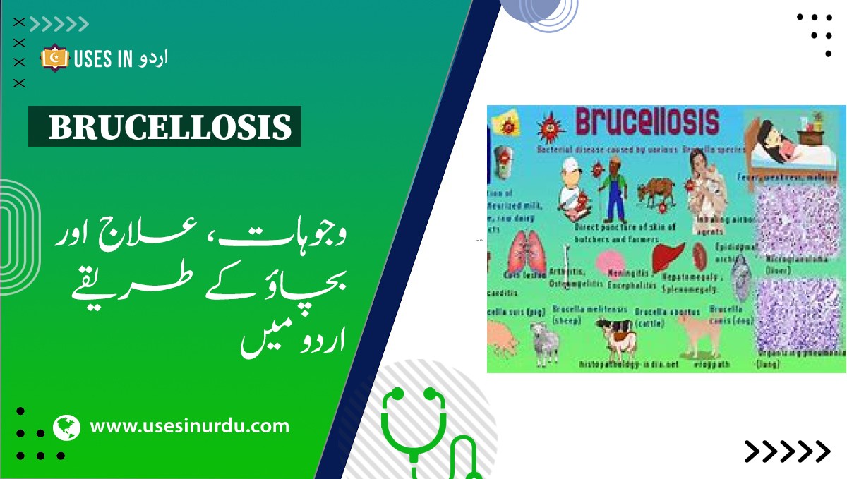 Brucellosis