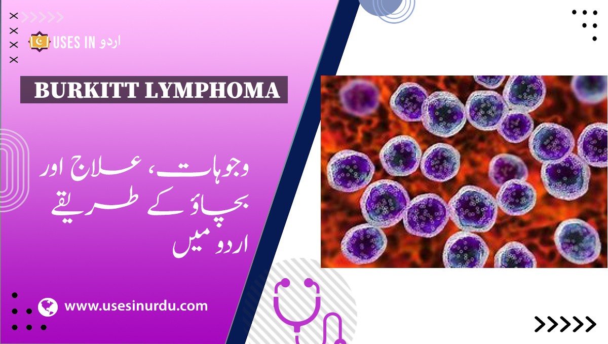 Burkitt Lymphoma