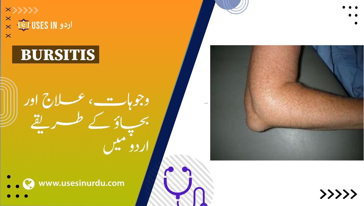 Bursitis