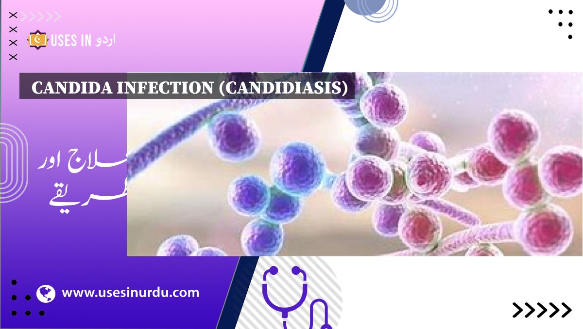 Candida Infection (Candidiasis)