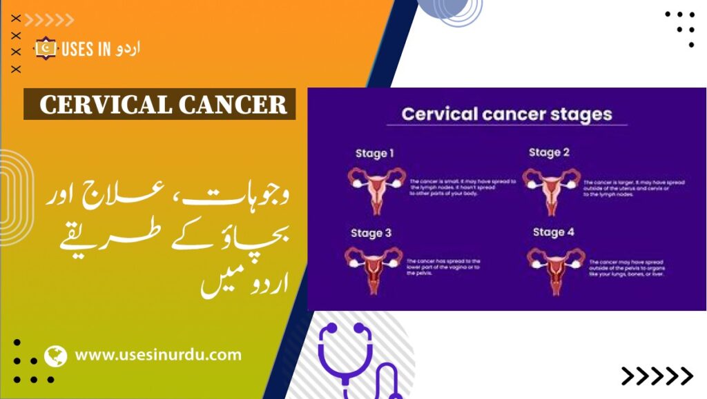 Cervical Cancer