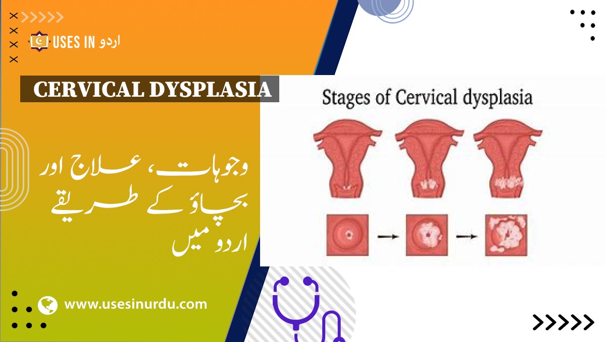 Cervical Dysplasia