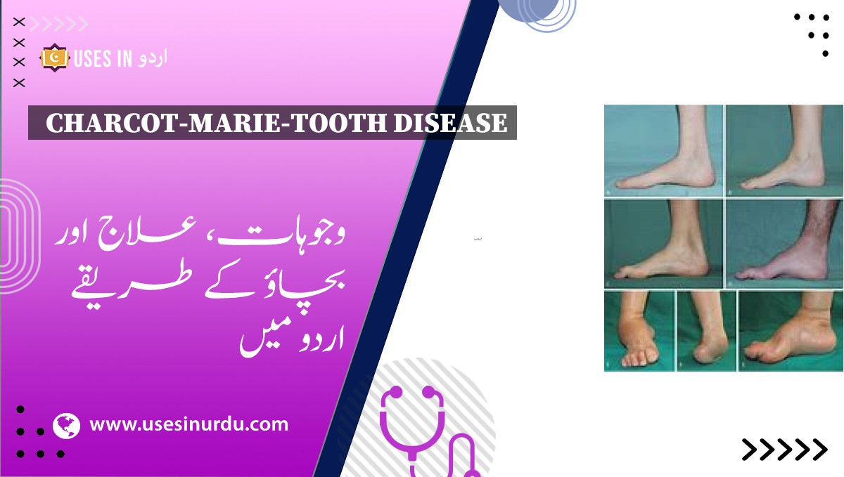 Charcot-Marie-Tooth Disease