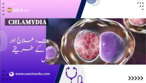 Chlamydia