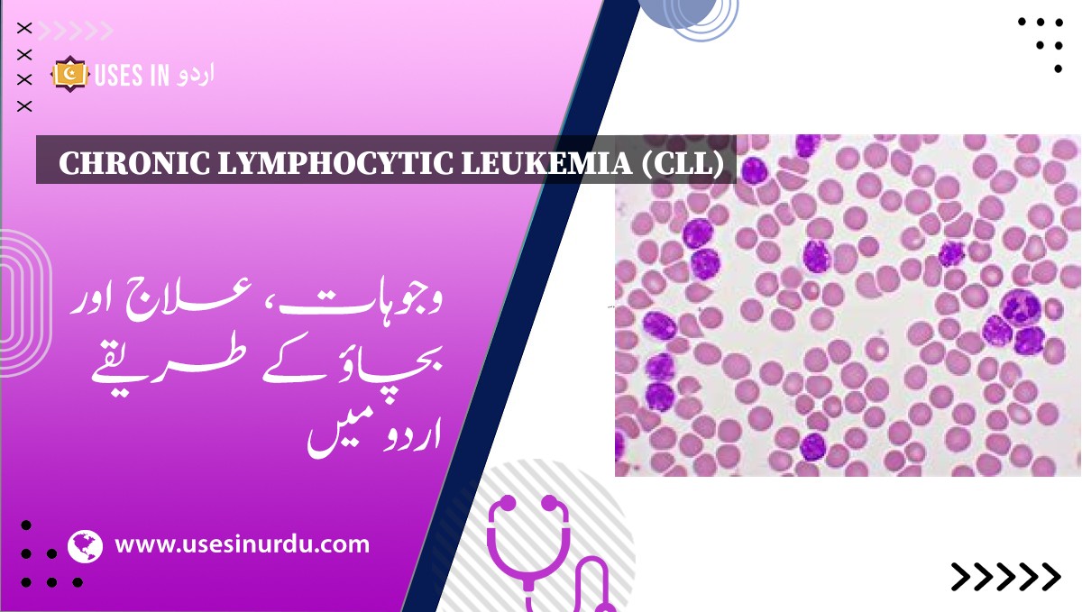 Chronic Lymphocytic Leukemia (CLL)