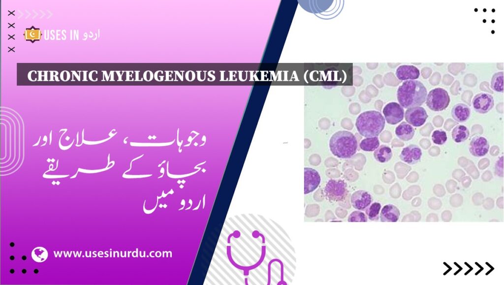 Chronic Myelogenous Leukemia (CML)