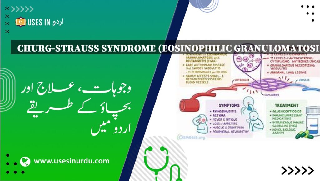 Churg-Strauss Syndrome (Eosinophilic Granulomatosis)