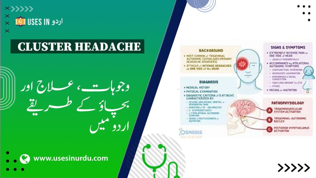 Cluster Headache