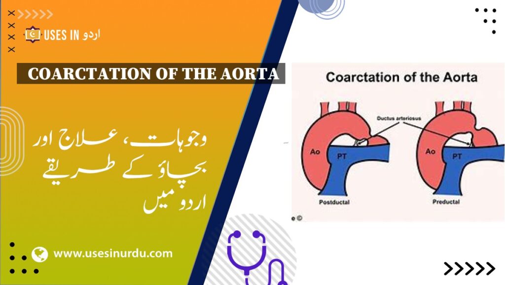 Coarctation of the Aorta